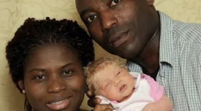 Bebê loira nascida de pais nigerianos intriga cientistas