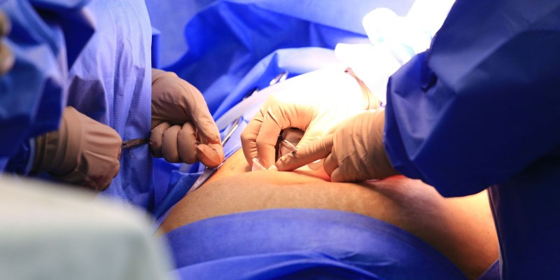 © Breno Esaki/Agência Saúde DF