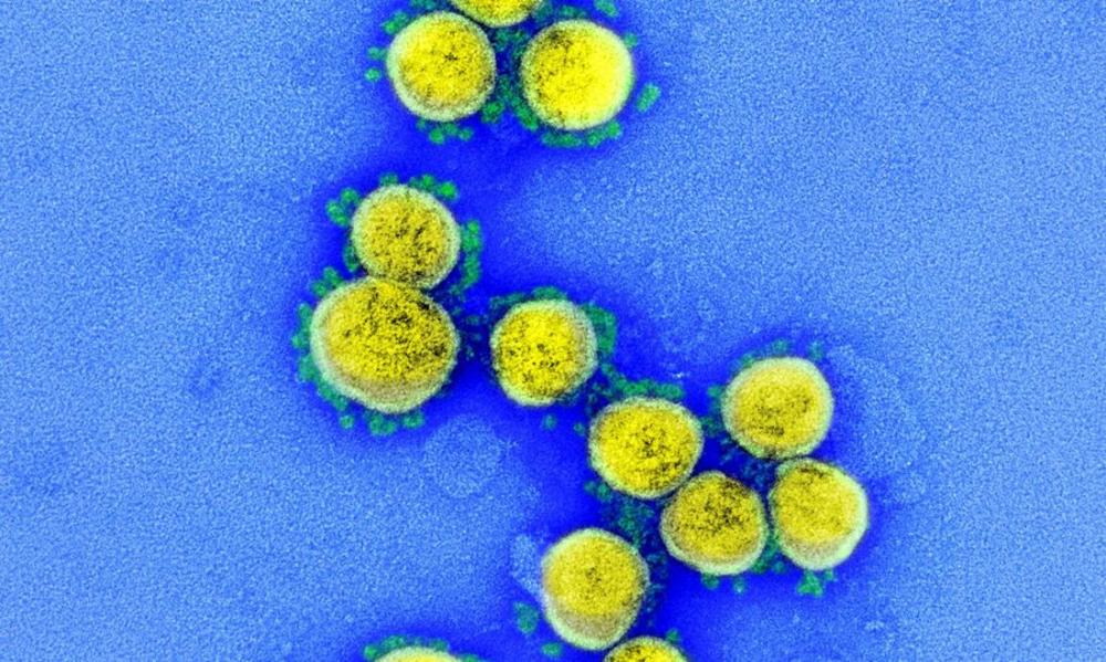 Imagem de microscópio do coronavírus - Foto: Niaid